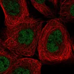Atlas Antibodies Anti-AGL Antibody