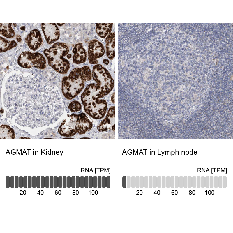 Atlas Antibodies Anti-AGMAT Antibody