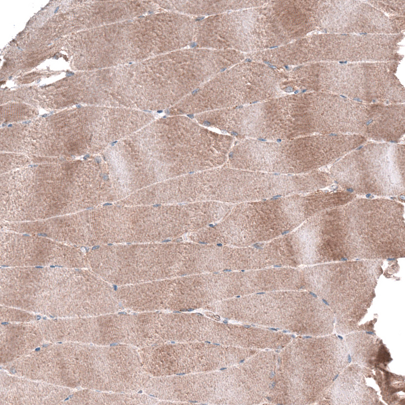 Atlas Antibodies Anti-AGL Antibody