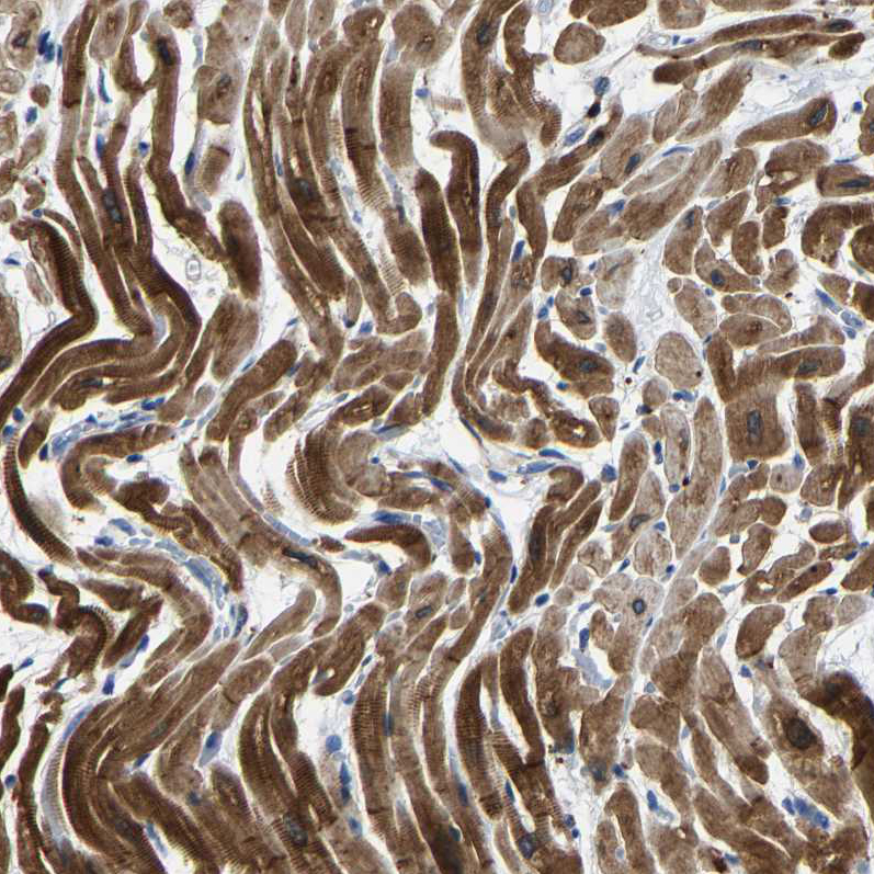 Atlas Antibodies Anti-AGK Antibody