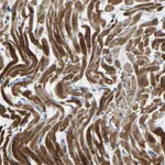 Atlas Antibodies Anti-AGK Antibody