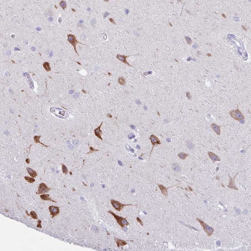 Atlas Antibodies Anti-AGO3 Antibody