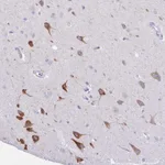 Atlas Antibodies Anti-AGO3 Antibody