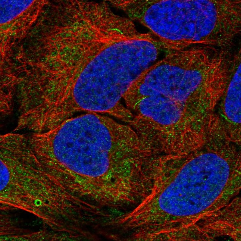 Atlas Antibodies Anti-AGPAT1 Antibody