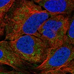 Atlas Antibodies Anti-AGPAT1 Antibody