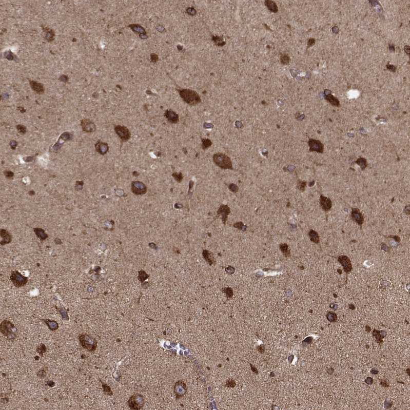Atlas Antibodies Anti-AGPAT1 Antibody