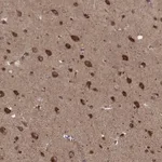 Atlas Antibodies Anti-AGPAT1 Antibody