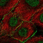 Atlas Antibodies Anti-AGO2 Antibody