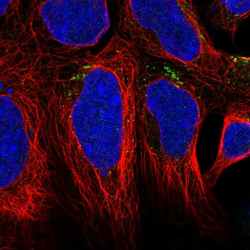 Atlas Antibodies Anti-AGPAT4 Antibody