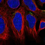 Atlas Antibodies Anti-AGPAT4 Antibody