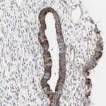 Atlas Antibodies Anti-AGPAT5 Antibody