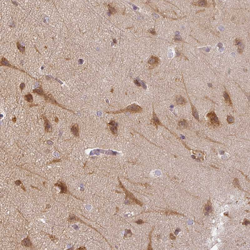 Atlas Antibodies Anti-AGPAT4 Antibody