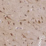 Atlas Antibodies Anti-AGPAT4 Antibody