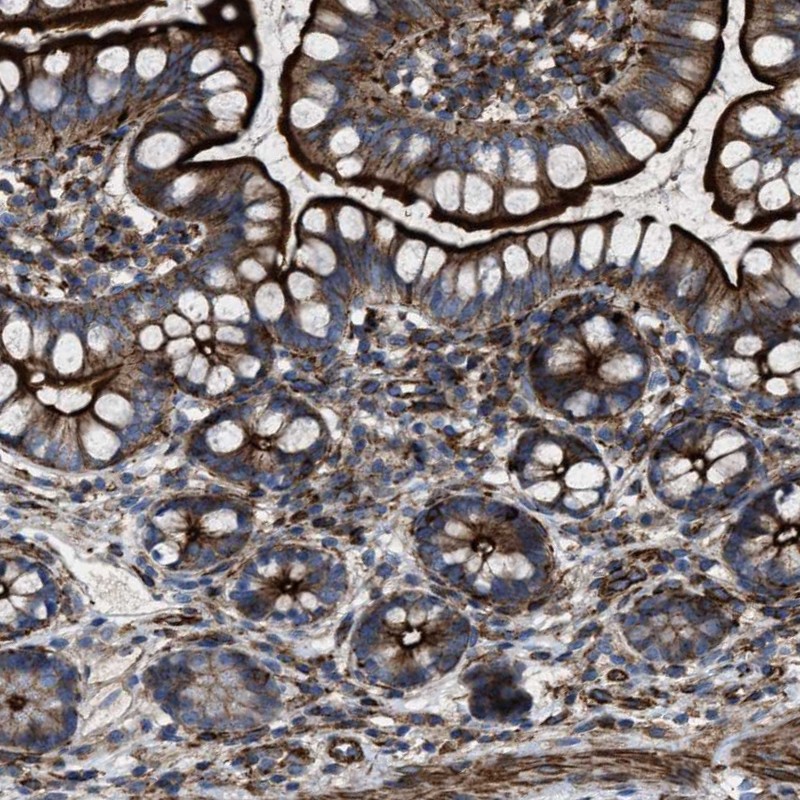 Atlas Antibodies Anti-AGPAT2 Antibody