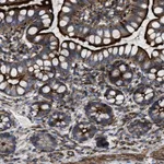 Atlas Antibodies Anti-AGPAT2 Antibody