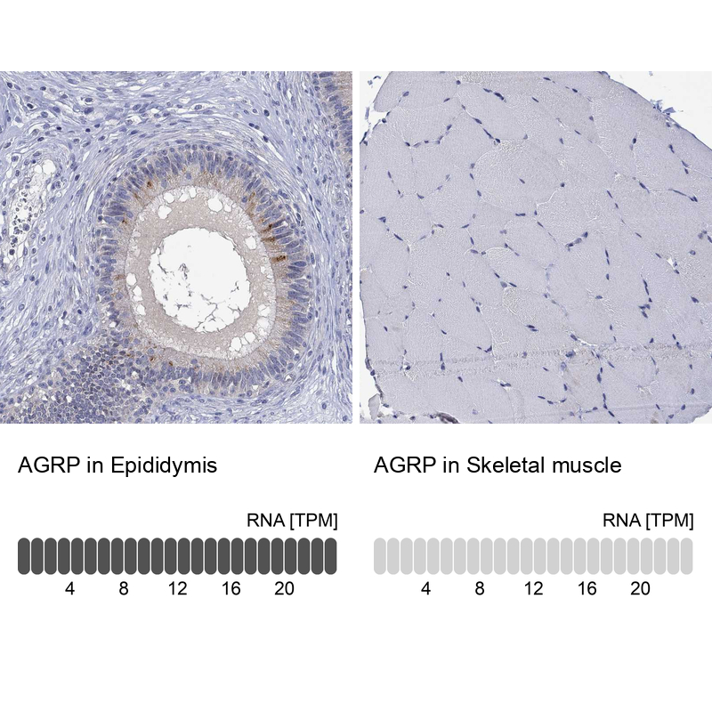 Atlas Antibodies Anti-AGRP Antibody
