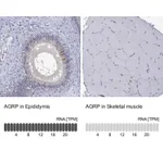 Atlas Antibodies Anti-AGRP Antibody