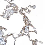 Atlas Antibodies Anti-AGRN Antibody
