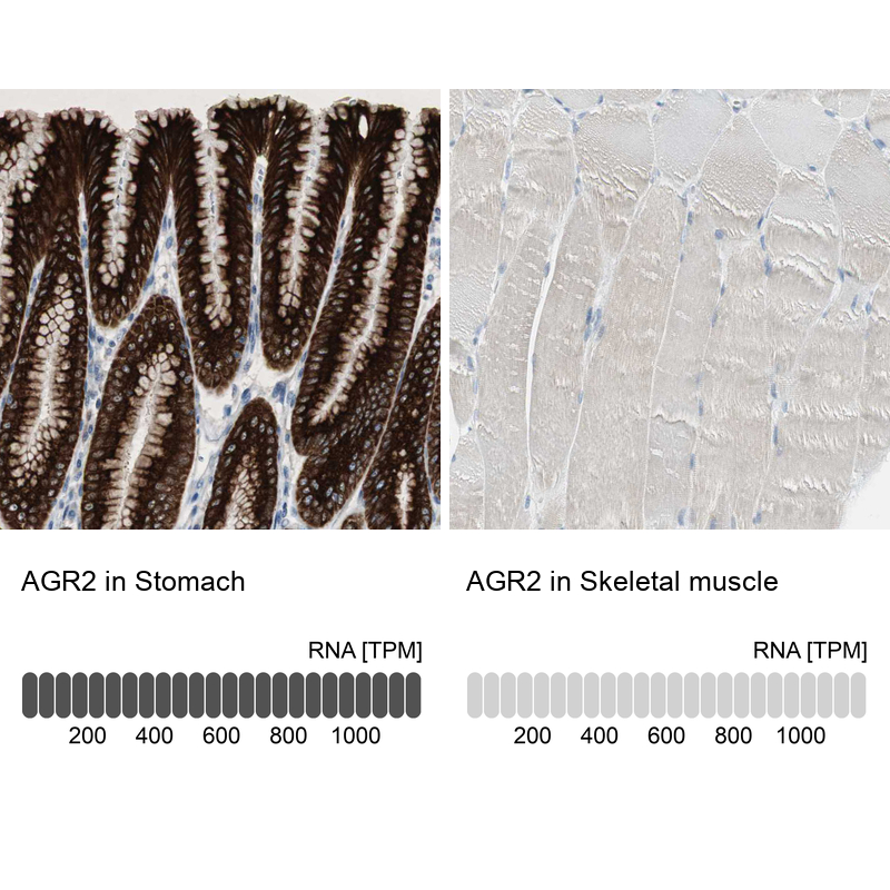 Atlas Antibodies Anti-AGR2 Antibody