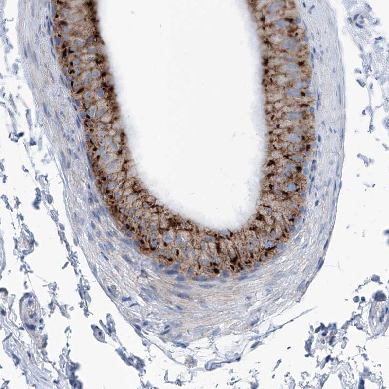 Atlas Antibodies Anti-AGPS Antibody