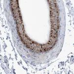 Atlas Antibodies Anti-AGPS Antibody