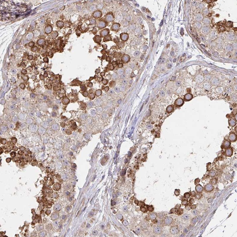 Atlas Antibodies Anti-AGTPBP1 Antibody