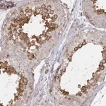 Atlas Antibodies Anti-AGTPBP1 Antibody