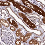 Atlas Antibodies Anti-AHCY Antibody