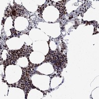 Atlas Antibodies Anti-AGTPBP1 Antibody