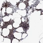 Atlas Antibodies Anti-AGTPBP1 Antibody