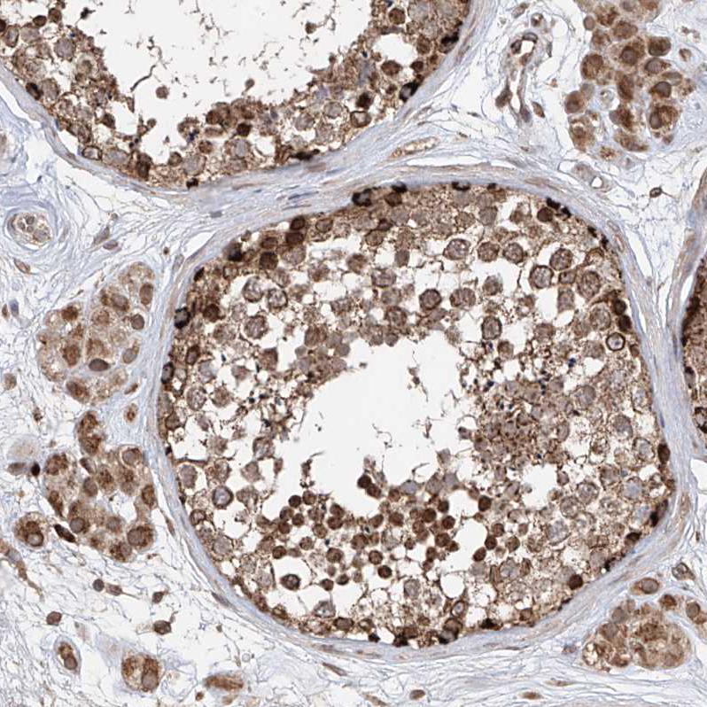Atlas Antibodies Anti-AHCTF1 Antibody