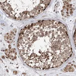 Atlas Antibodies Anti-AHCTF1 Antibody