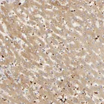 Atlas Antibodies Anti-AGT Antibody