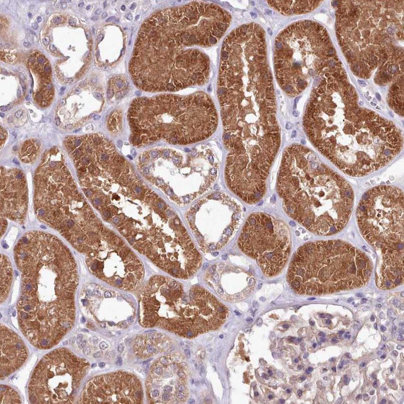 Atlas Antibodies Anti-AHCY Antibody