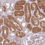 Atlas Antibodies Anti-AHCY Antibody