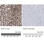 Atlas Antibodies Anti-AGXT Antibody