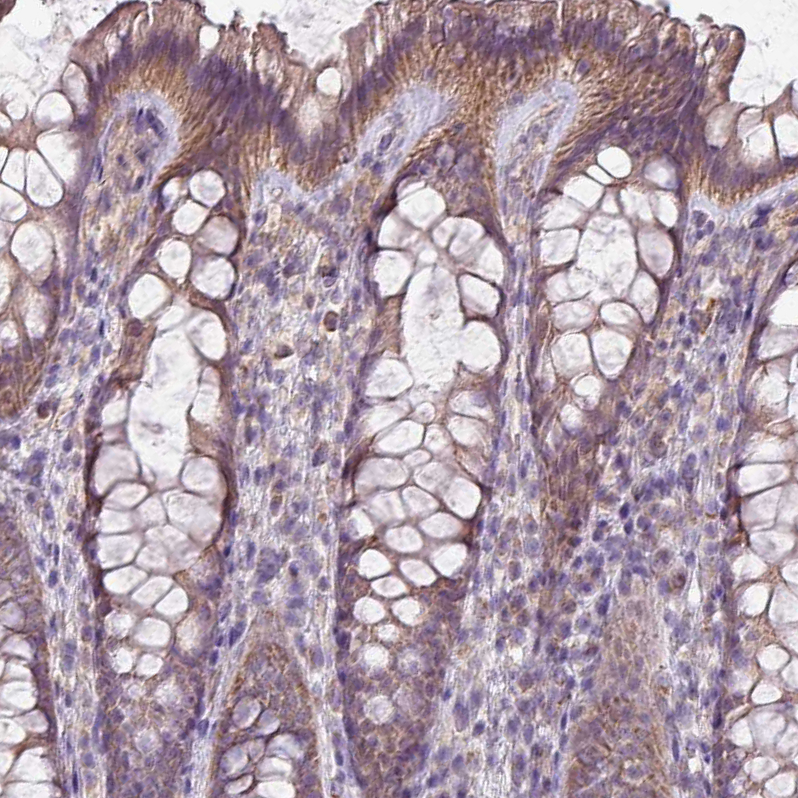 Atlas Antibodies Anti-LRRC9 Antibody