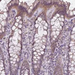 Atlas Antibodies Anti-LRRC9 Antibody