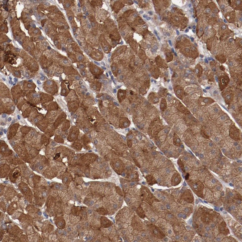 Atlas Antibodies Anti-LRRC75B Antibody