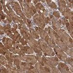 Atlas Antibodies Anti-LRRC75B Antibody