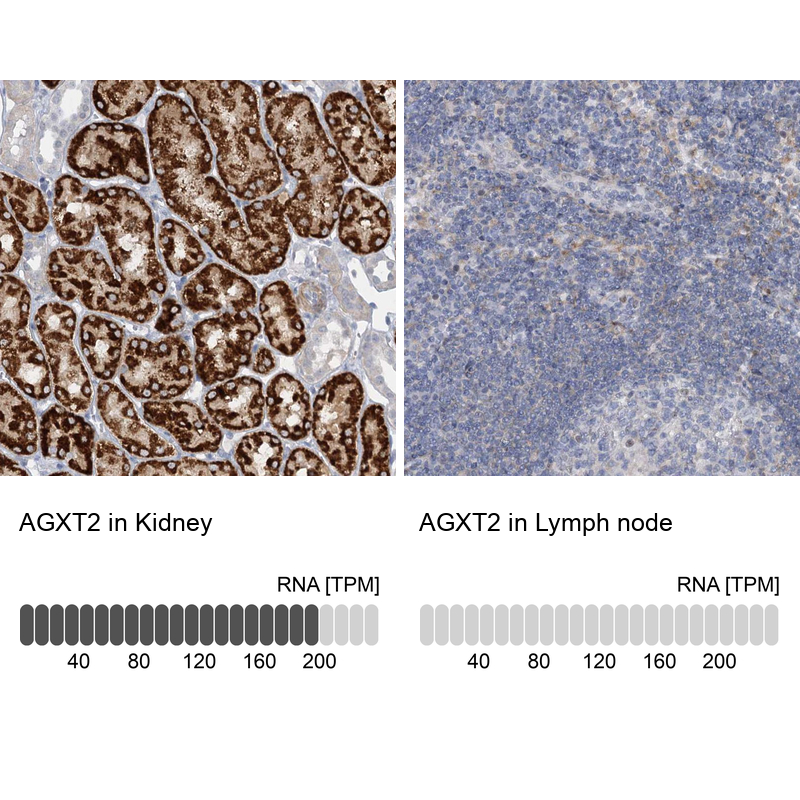 Atlas Antibodies Anti-AGXT2 Antibody