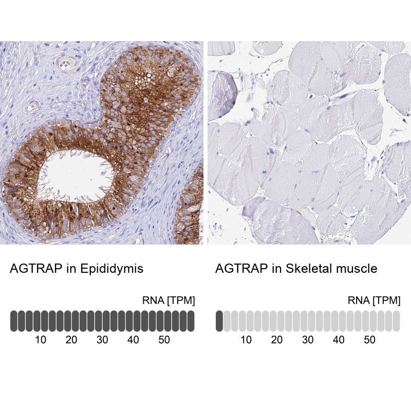 Atlas Antibodies Anti-AGTRAP Antibody