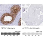 Atlas Antibodies Anti-AGTRAP Antibody