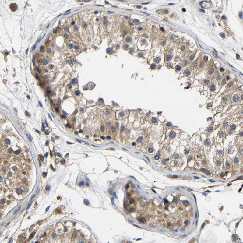 Atlas Antibodies Anti-LRRCC1 Antibody