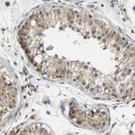 Atlas Antibodies Anti-LRRCC1 Antibody