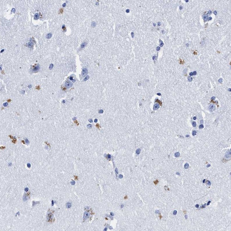Atlas Antibodies Anti-LRRC8E Antibody