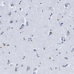 Atlas Antibodies Anti-LRRC8E Antibody