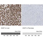 Atlas Antibodies Anti-AGXT Antibody