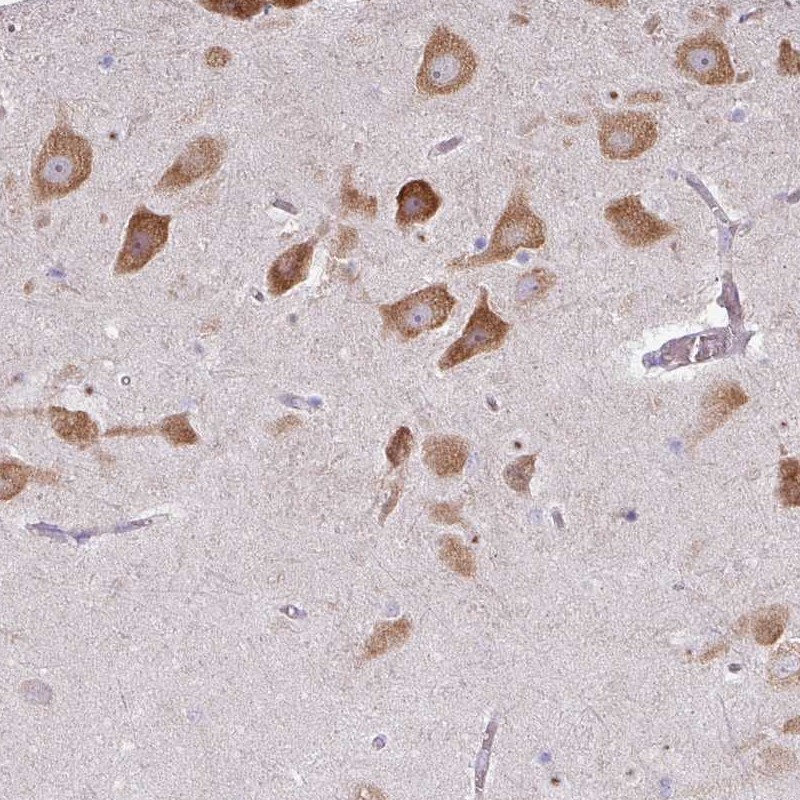 Atlas Antibodies Anti-LRRC9 Antibody