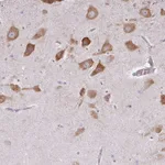 Atlas Antibodies Anti-LRRC9 Antibody